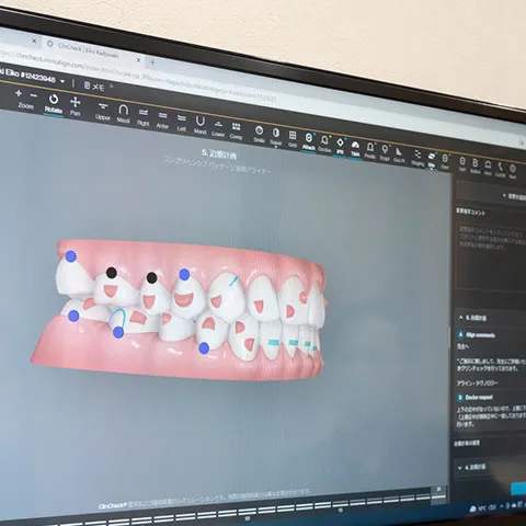 シミュレーションソフトの活用｜中野区の大人の矯正歯科は東中野矯正歯科