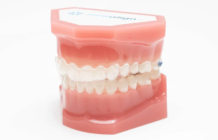 マウスピース矯正｜中野区のこどもの矯正歯科は東中野矯正歯科