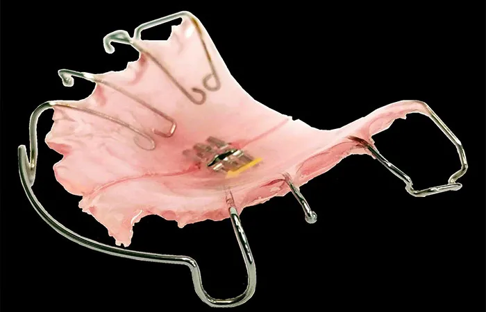 床矯正｜中野区のこどもの矯正歯科は東中野矯正歯科